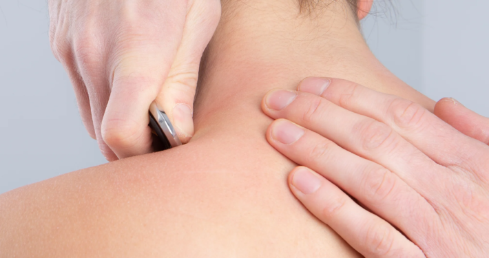 MYOFASCIAL-RELEASE_Physio-TEPASS MYOFASCIAL-RELEASE Physio TEPASS